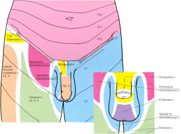 Genitofemoral Neuralgia